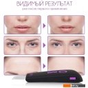 Приборы для ухода за кожей Gess You GESS-689